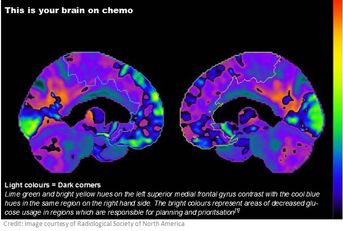 chemo brain 2